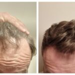 4155-hairs-Sergey (1)